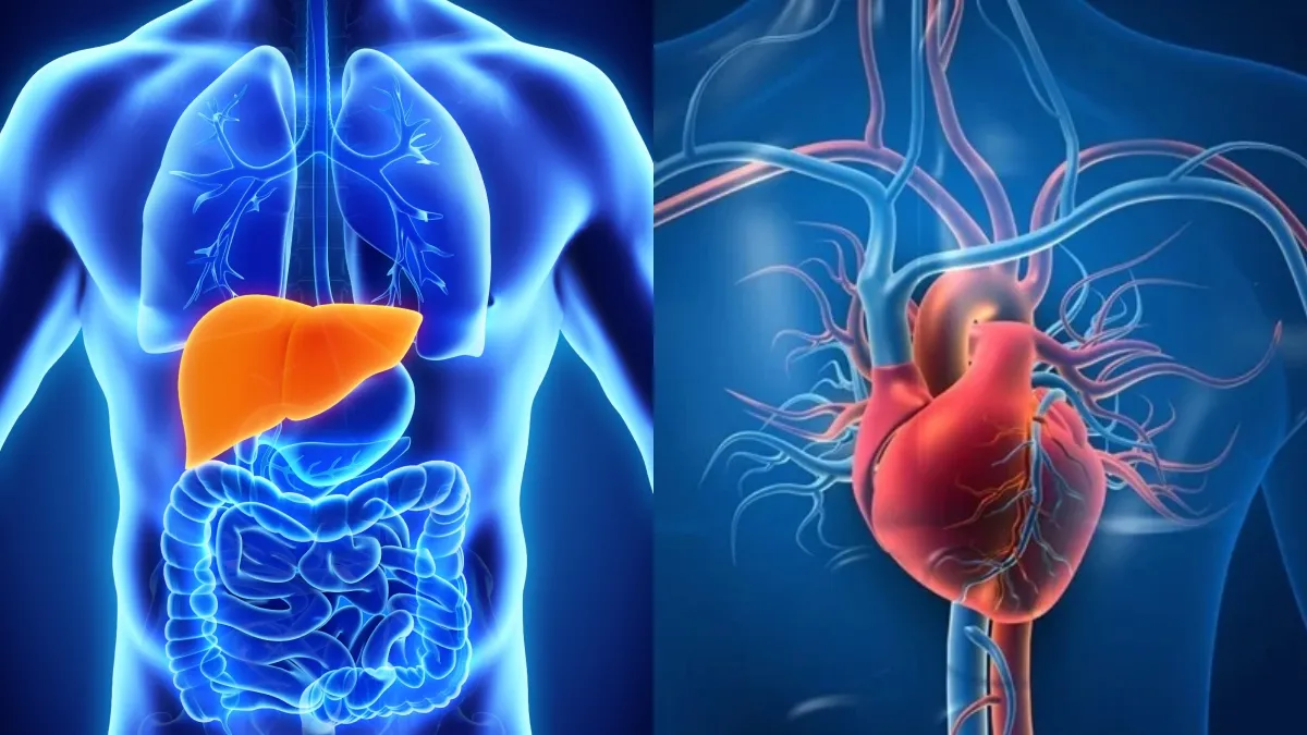 Liver Fibrosis and AMI - LiverRight: Virtual Liver Disease Clinic